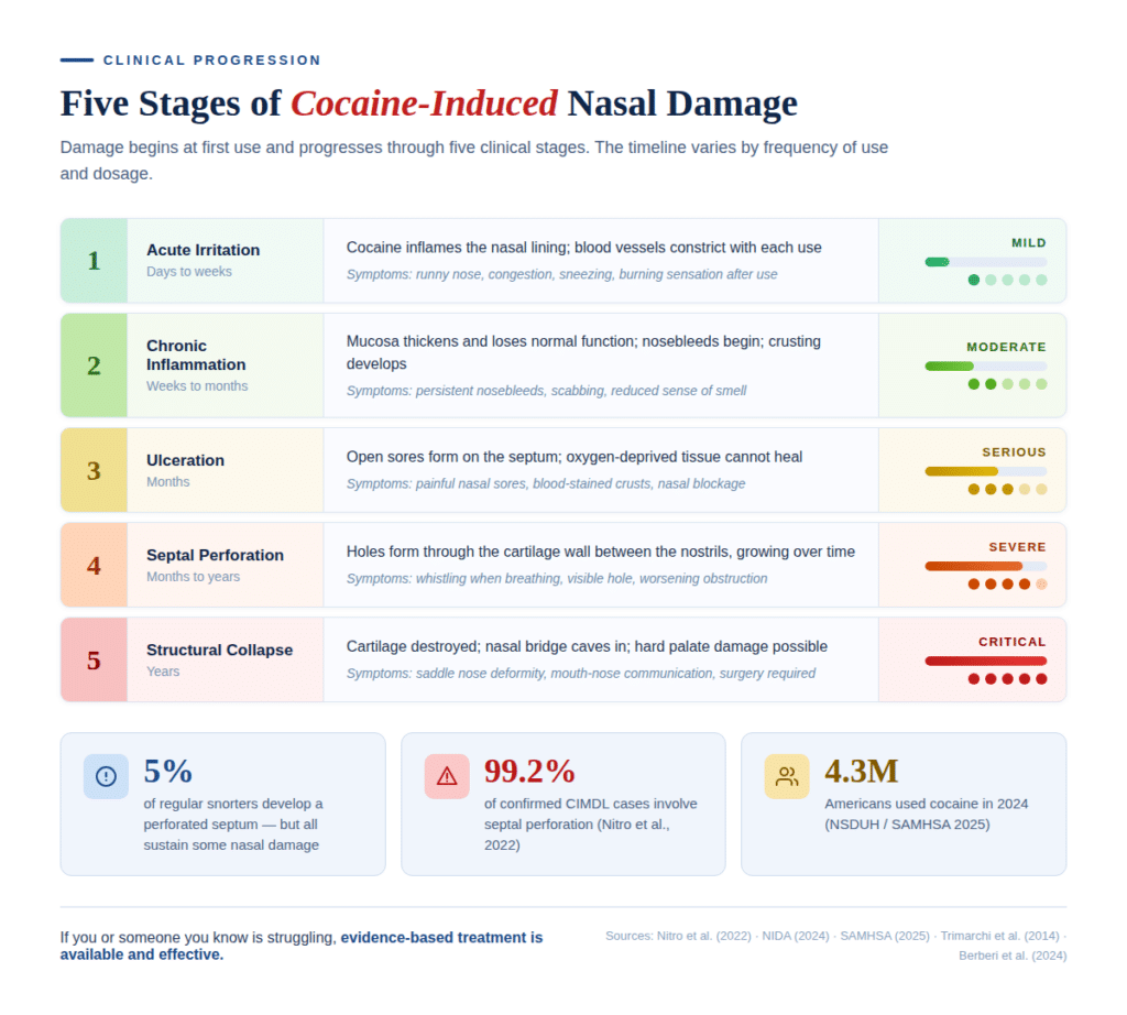 the 5 stages of cocaine damaging the nose
